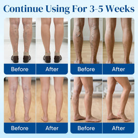 2Box step-by-step application image showing easy, painless use