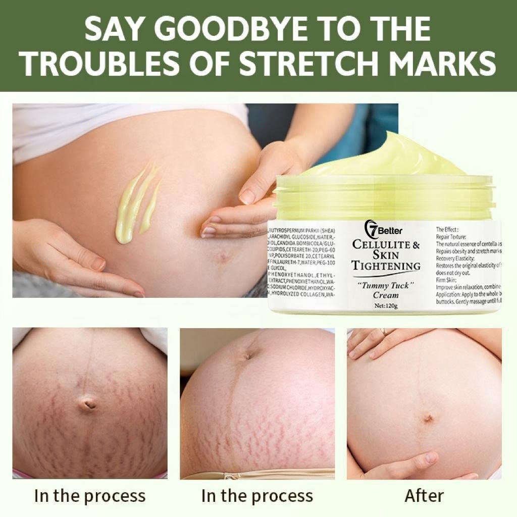 7better LLC applying cream to abdomen demonstrating gentle care