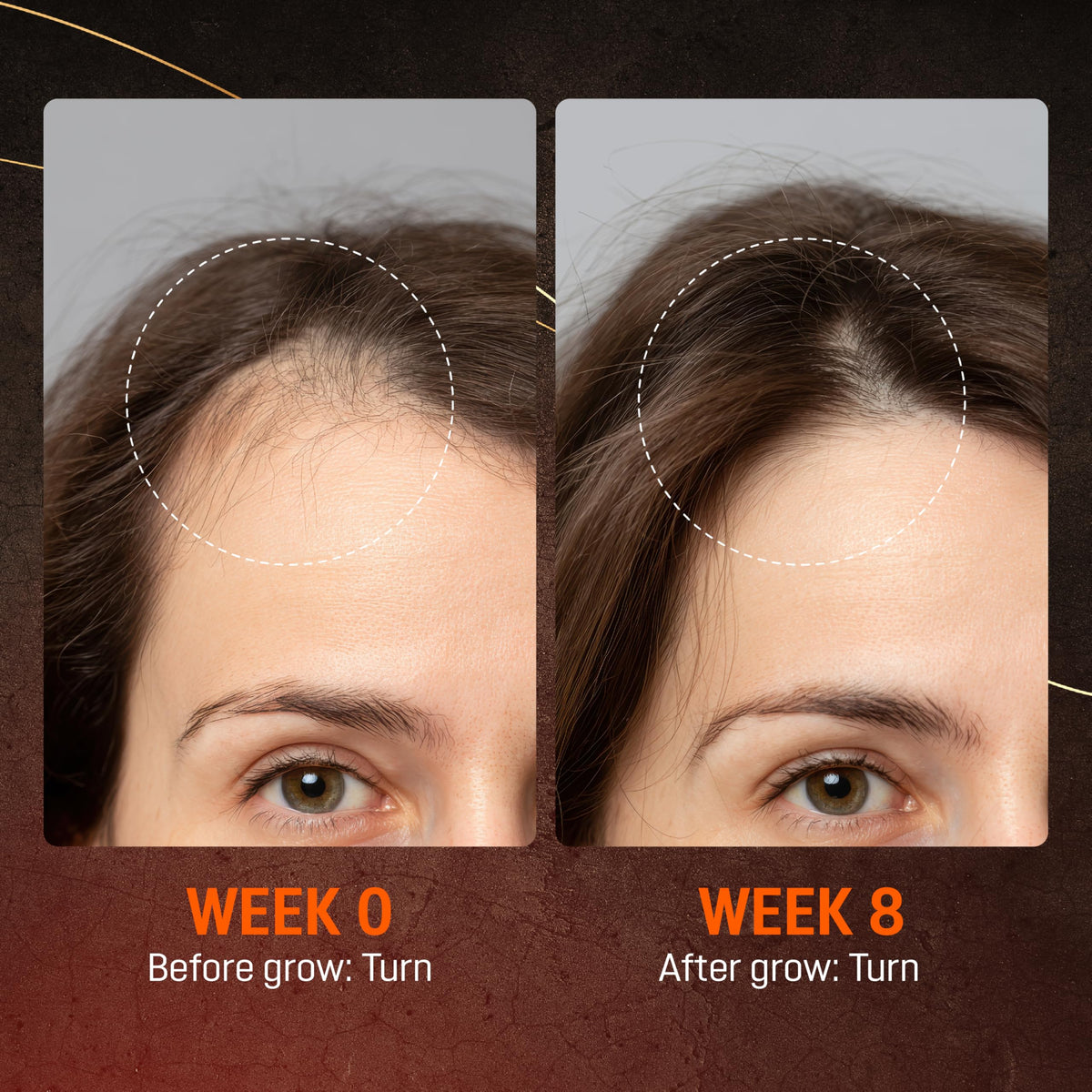 ABERA beard area before and after comparison, shows fuller-looking facial hair benefit