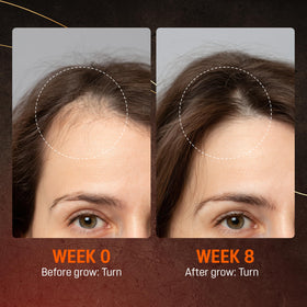 ABERA beard area before and after comparison, shows fuller-looking facial hair benefit