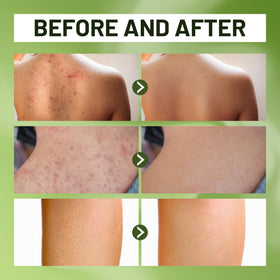 ABERA close-up gel texture highlighting gentle exfoliating feel