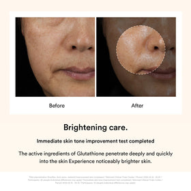 Abib before and after scale showing improved evenness and visible radiance