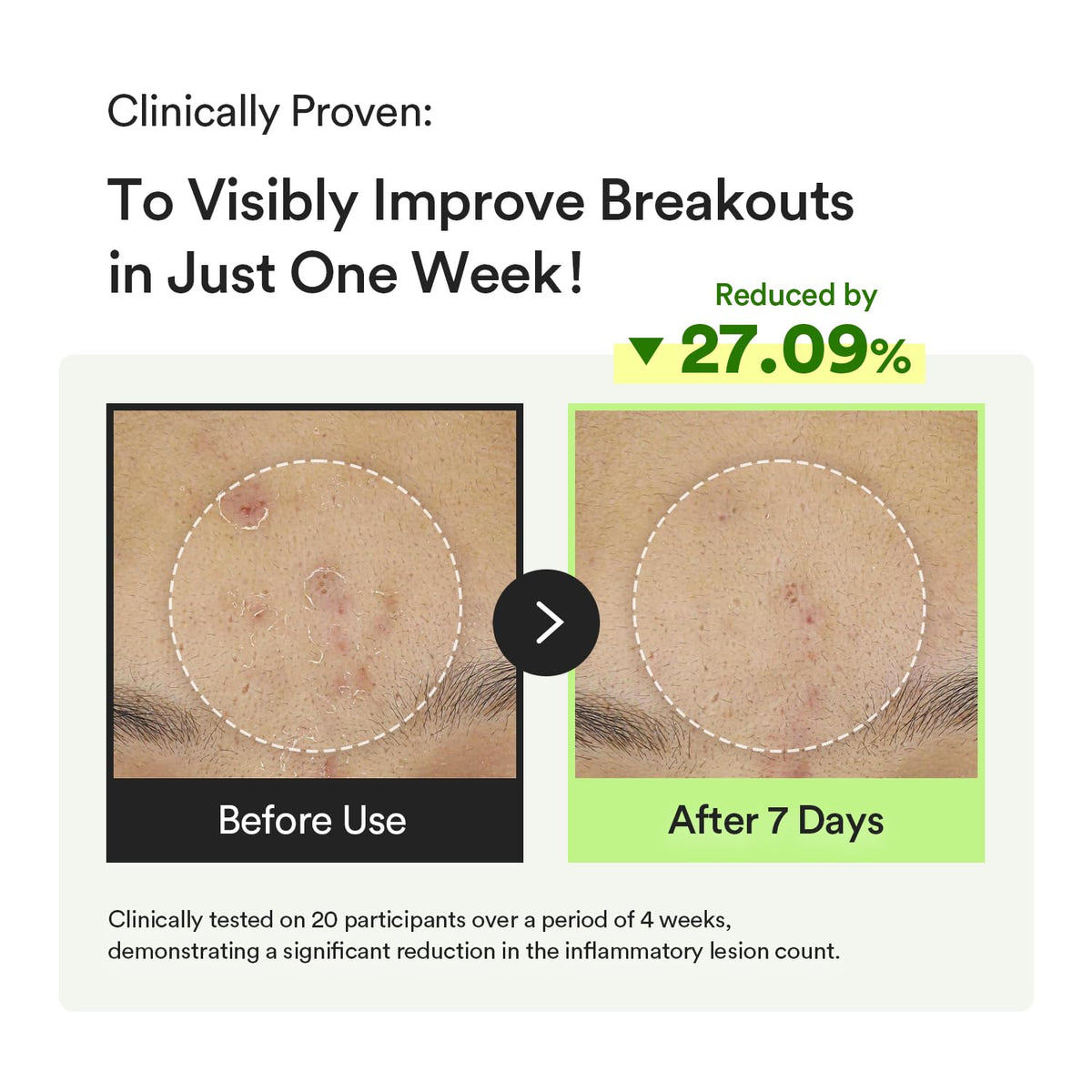 Abib pipette applying serum emphasizing precise, mess-free use