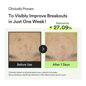 Abib pipette applying serum emphasizing precise, mess-free use