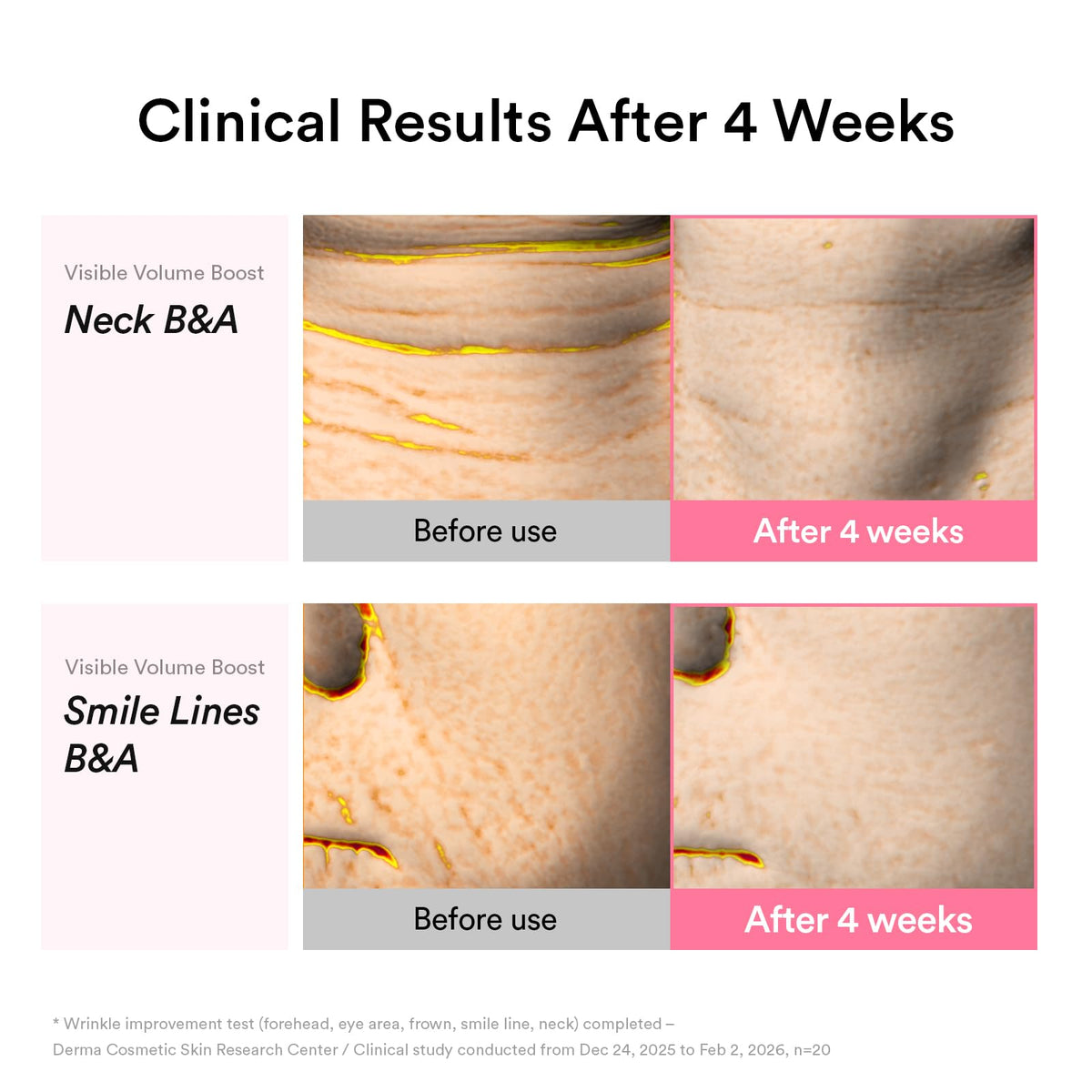 Abib used on neck in lifestyle shot conveying firmer, lifted-looking skin