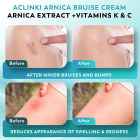 ACLINKI ingredients display with arnica and vitamins highlighting botanical support
