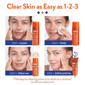 AcneFree 10% benzoyl peroxide lotion pouring to show treatment strength