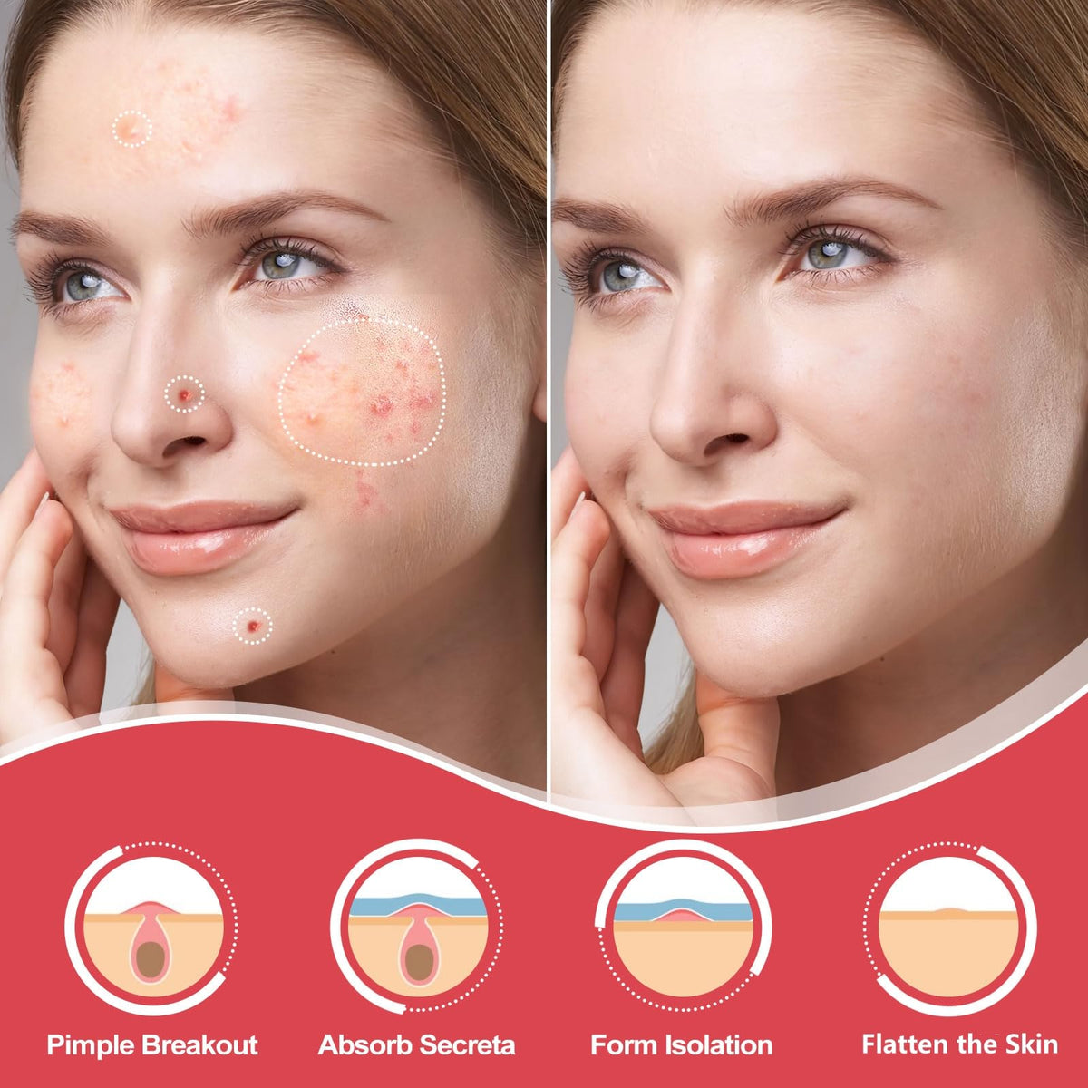 AcneGo close-up of thin hydrocolloid texture showing discreet coverage