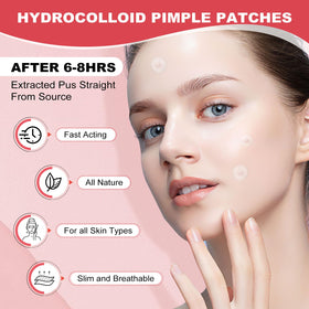 AcneGo patches in hand demonstrating easy dispensing and portability