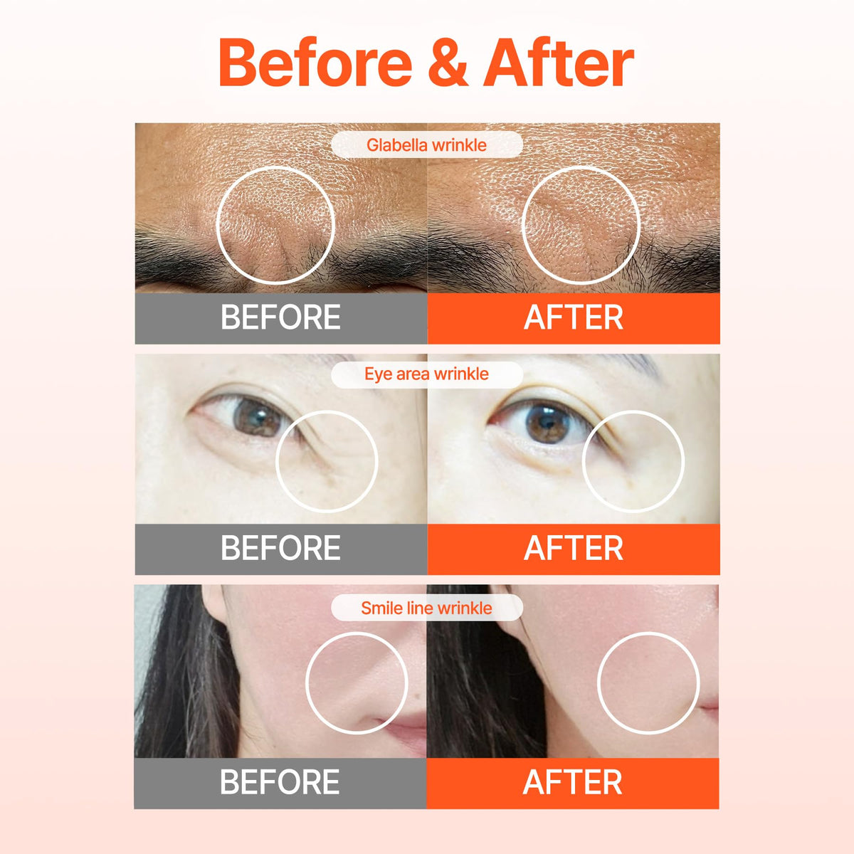 Patch applied near eye area showing Acropass discreet fit and comfort