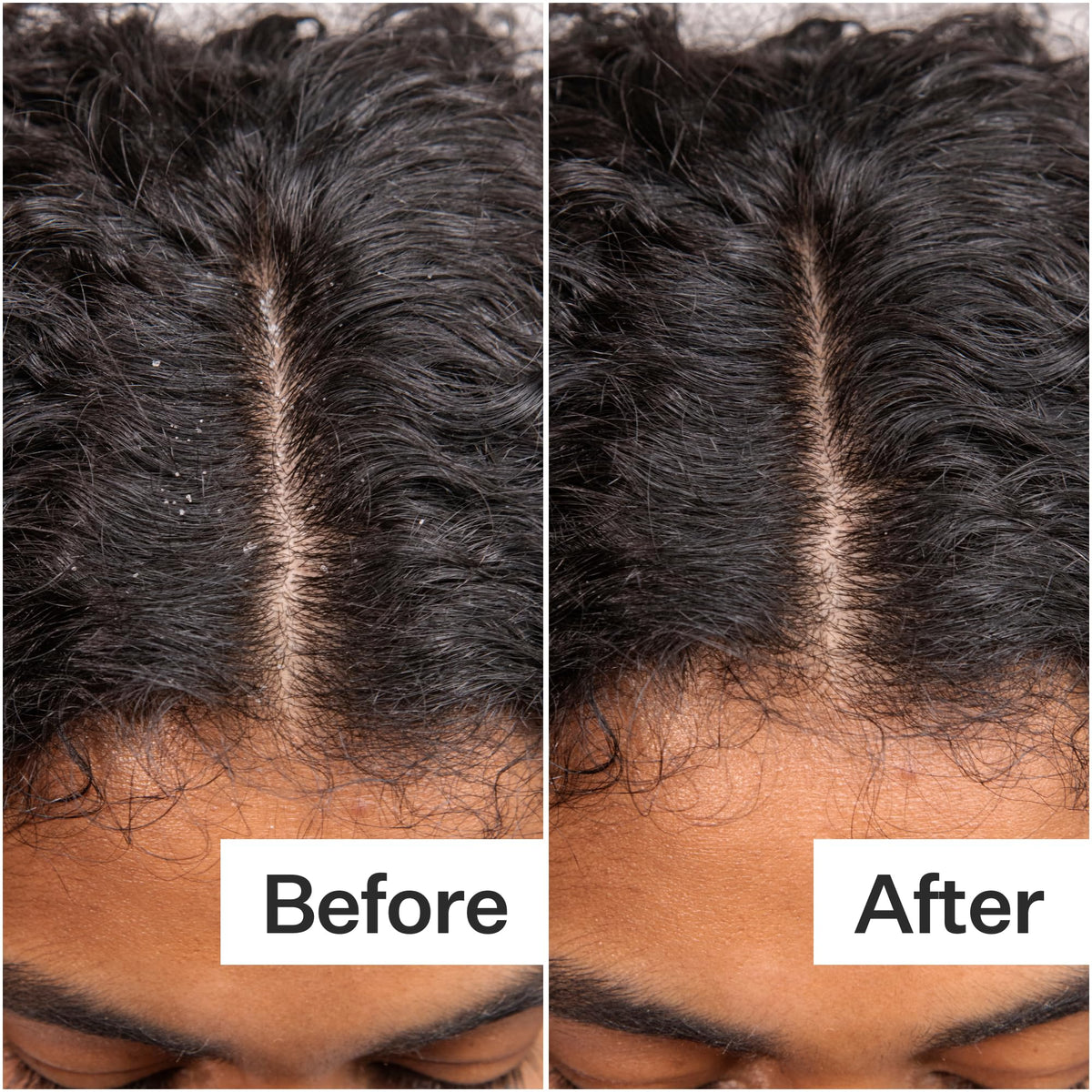 ACT+ ACRE ingredient focus showing hyaluronic acid and amino acids benefits