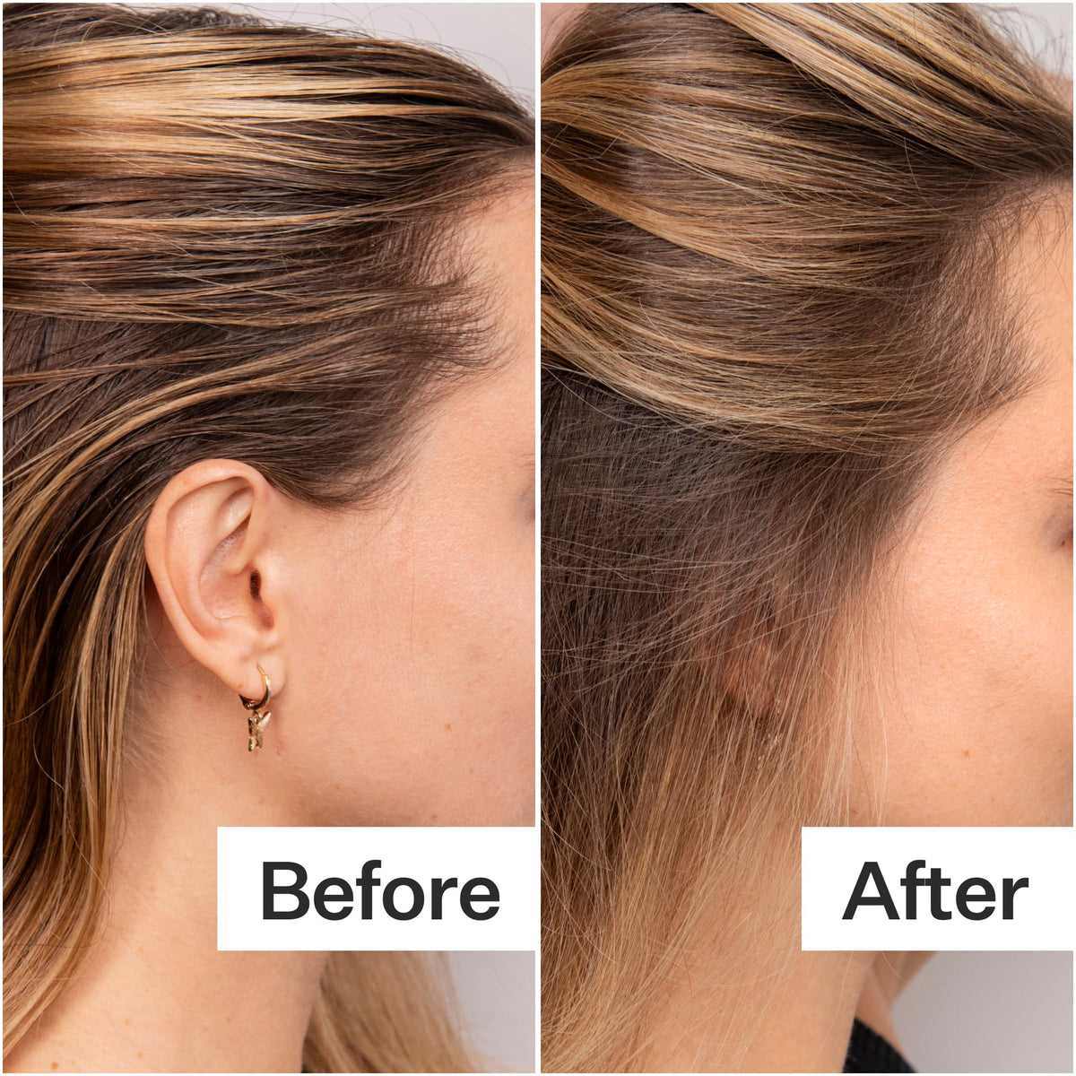 ACT+ ACRE side-by-side roots before and after for visible volume boost