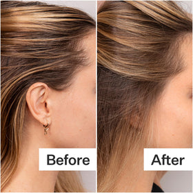 ACT+ ACRE side-by-side roots before and after for visible volume boost