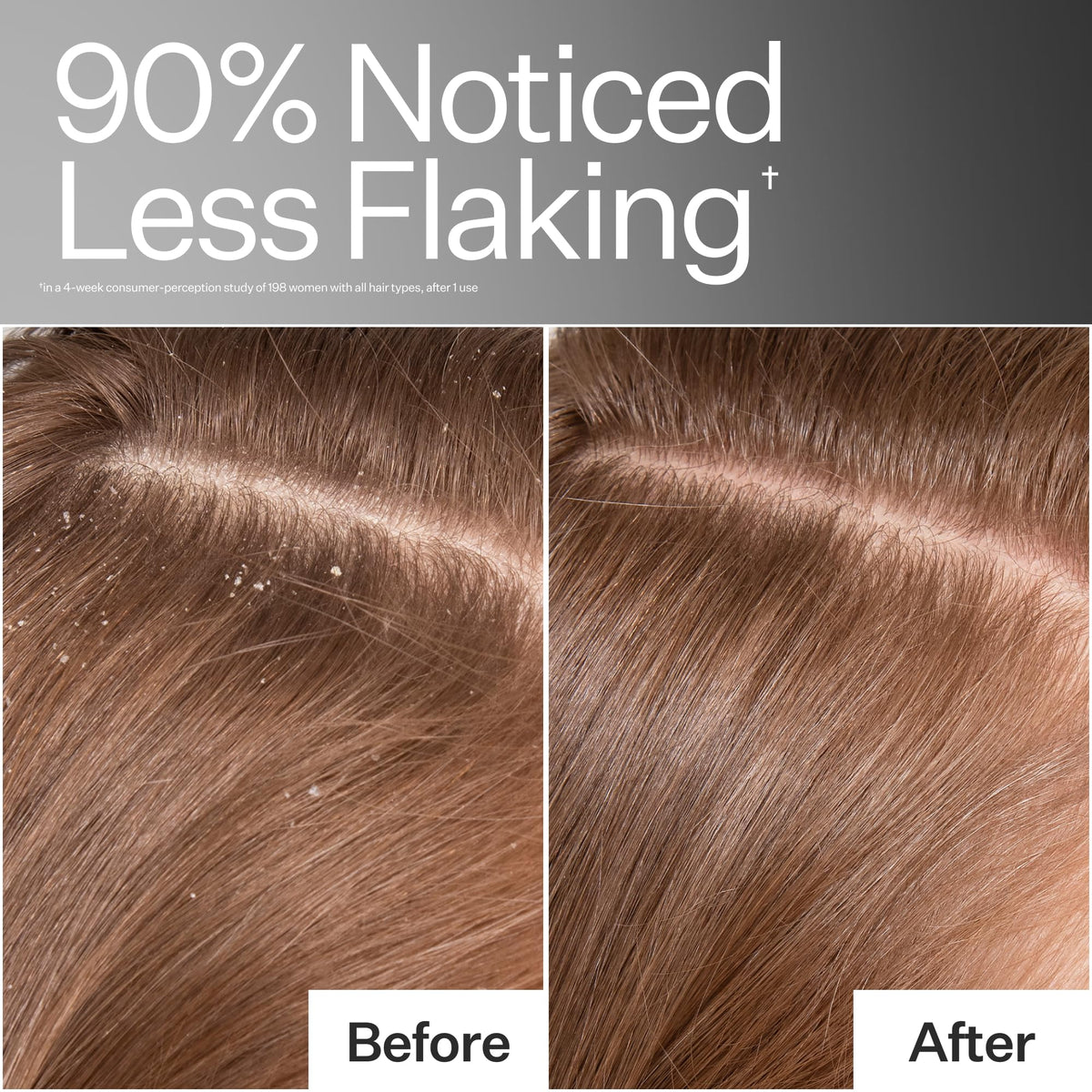 ACT+ ACRE application massage on scalp illustrating easy distribution