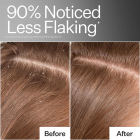 ACT+ ACRE application massage on scalp illustrating easy distribution