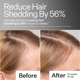 ACT+ ACRE close-up pipette dispensing serum for precise scalp application benefit
