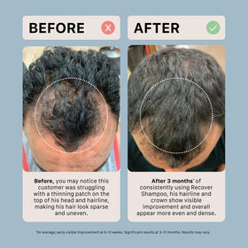 ACTIIV shampoo in-shower application demonstrating scalp cleansing benefit