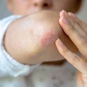 Adamia being squeezed onto hand showing quick application and non-greasy feel