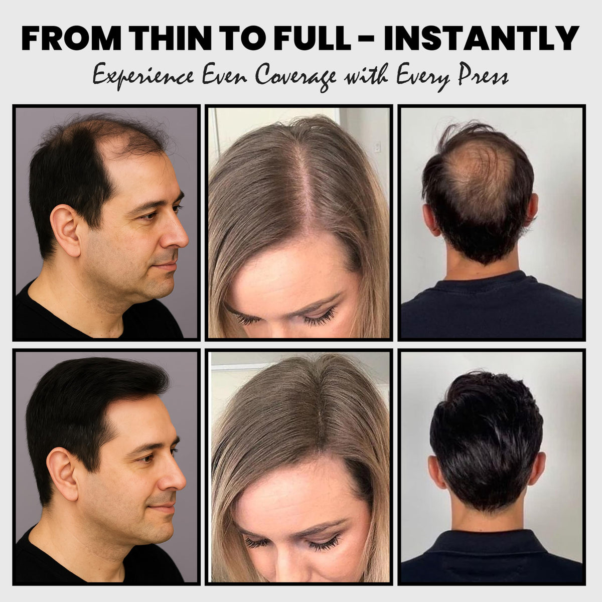 Adglamful before and after comparison showing fuller-looking hair and improved confidence