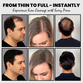 Adglamful before and after comparison showing fuller-looking hair and improved confidence