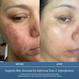 Admire My Skin cream texture close-up illustrating smooth hydrating consistency