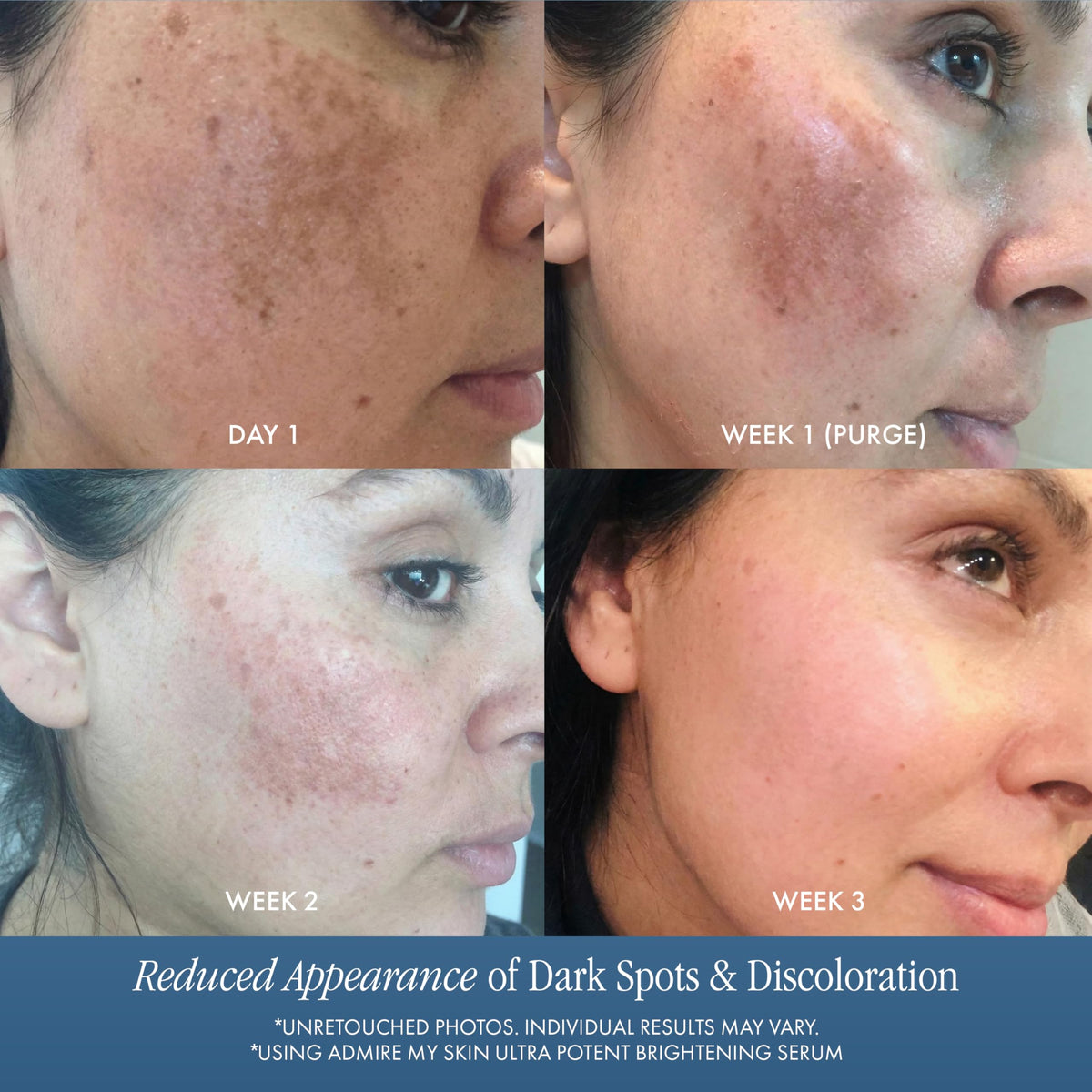 Admire My Skin application on hand demonstrating coverage and gentle feel