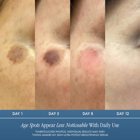Admire My Skin label close-up revealing kojic, azelaic and Synovea HR benefits