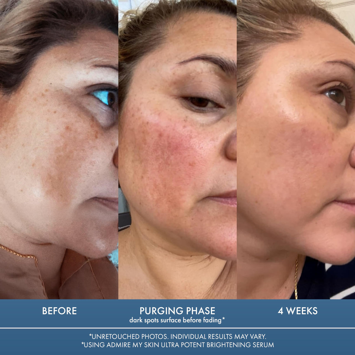 Admire My Skin texture close-up showing lightweight serum for quick absorption