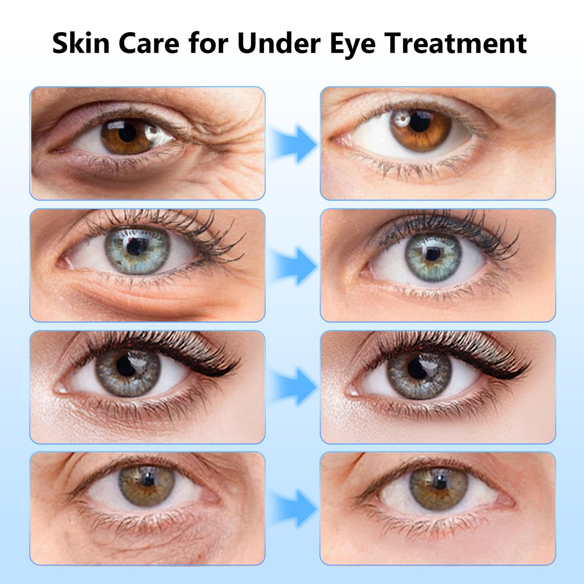 Adofect four color patches displayed to show gold, hyaluronic, retinol, caffeine benefits