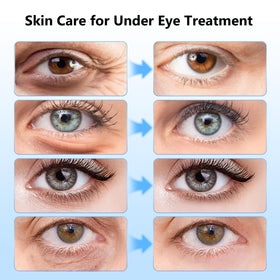 Adofect four color patches displayed to show gold, hyaluronic, retinol, caffeine benefits