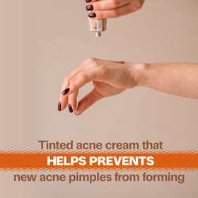 Adult Acnomel open cap displaying cream texture and non-greasy finish benefit