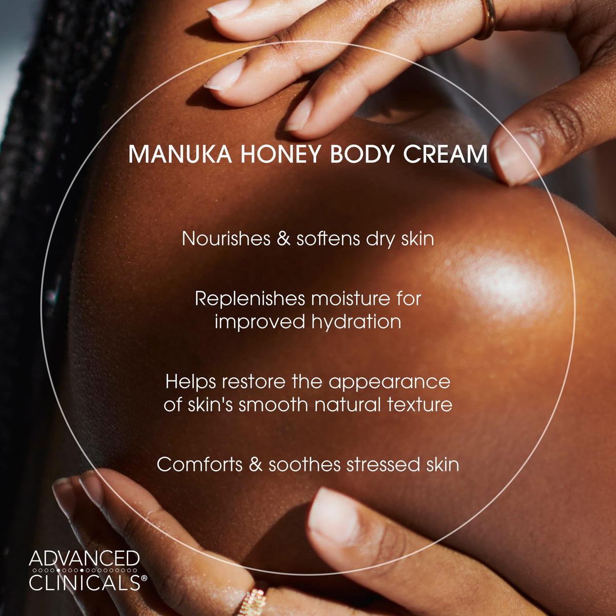 Advanced Clinicals product applied to knee and elbow to smooth rough areas