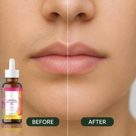 Aerifia being applied to underarm skin to soothe after hair removal