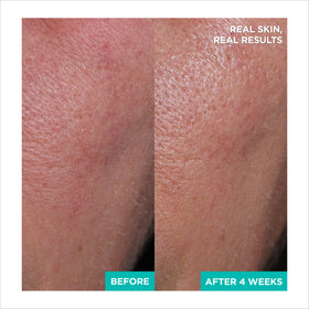 AESTURA ingredients label with centella and hyaluronic acid listed, shows key actives