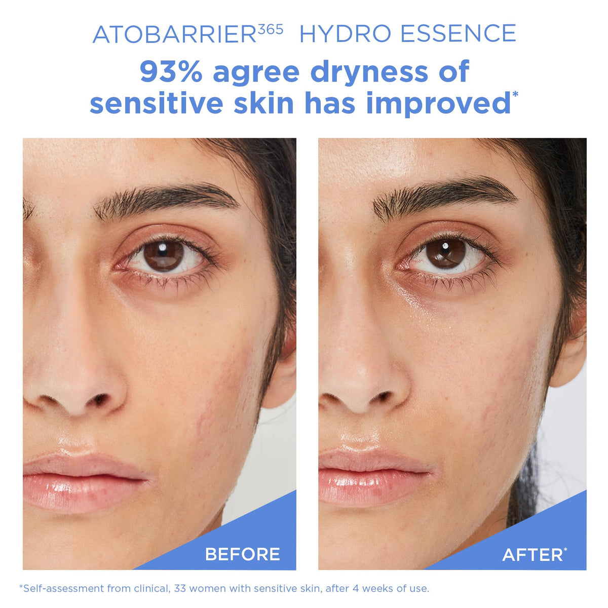 AESTURA applying essence to hand illustrating smooth spreadability and hydration effect