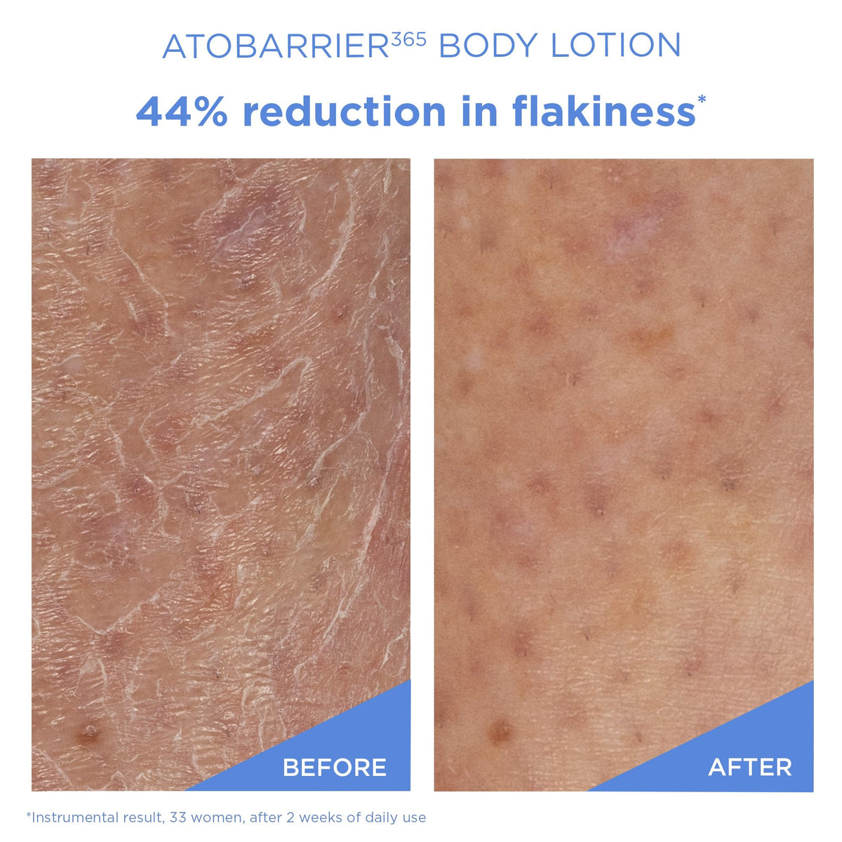AESTURA close-up texture of lotion showing lightweight cream that absorbs quickly