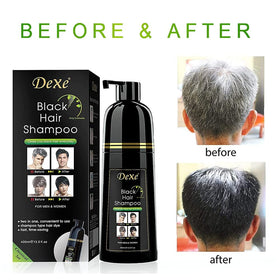 Agthyuve Dexe applied during shampooing, demonstrating easy 5–10 minute at-home use benefit