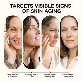 AIPILER Olivita applied to neck showing firmer jawline support