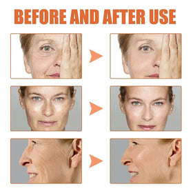 AKEASS comparative skin texture before and after to show visible smoothing