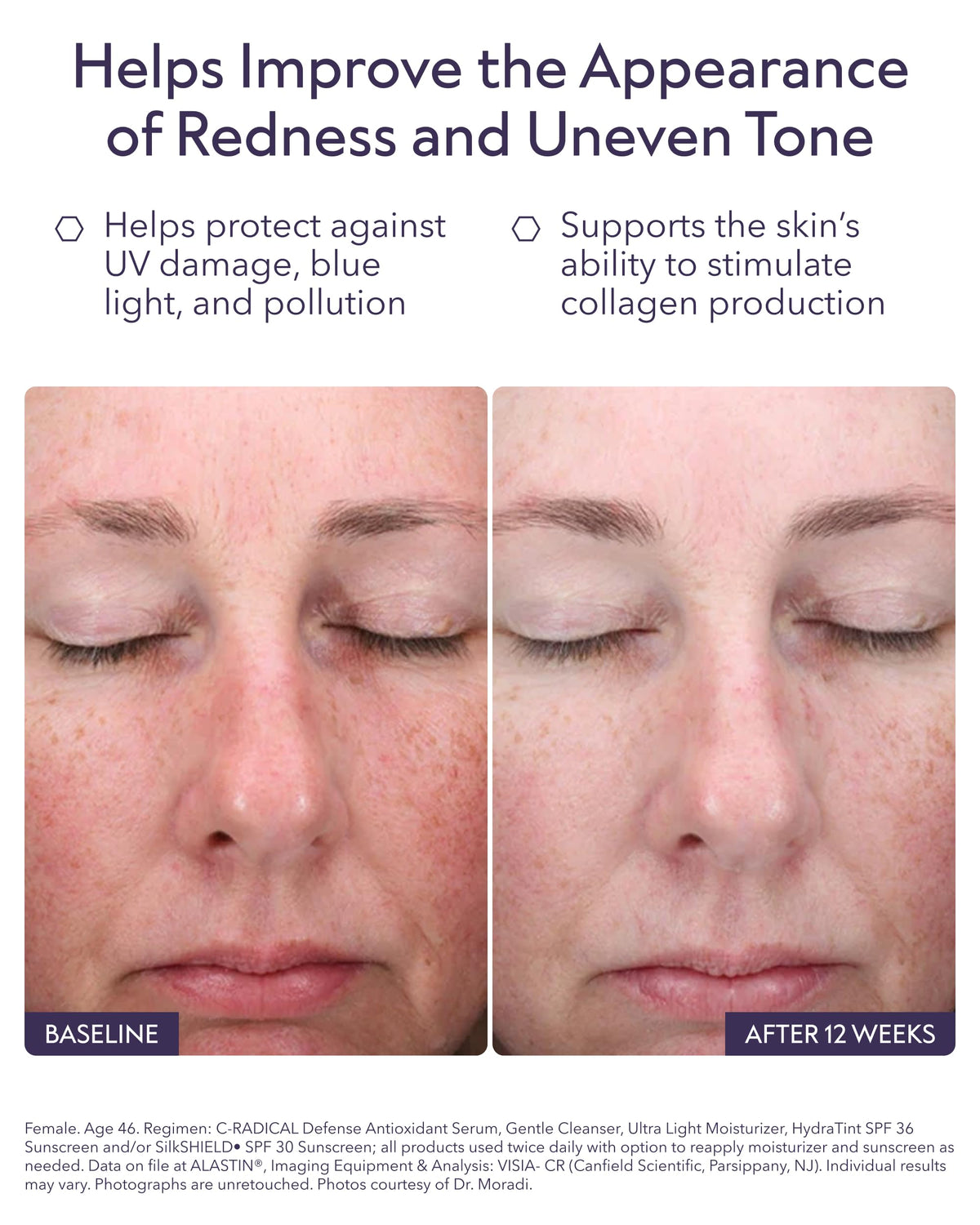 ALASTIN Skincare close-up of serum texture, highlighting lightweight hydration and fast absorption