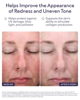 ALASTIN Skincare close-up of serum texture, highlighting lightweight hydration and fast absorption