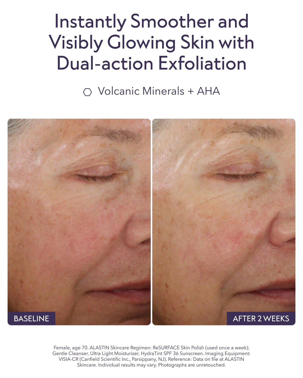 ALASTIN Skincare volcanic minerals ingredient to lift dead skin