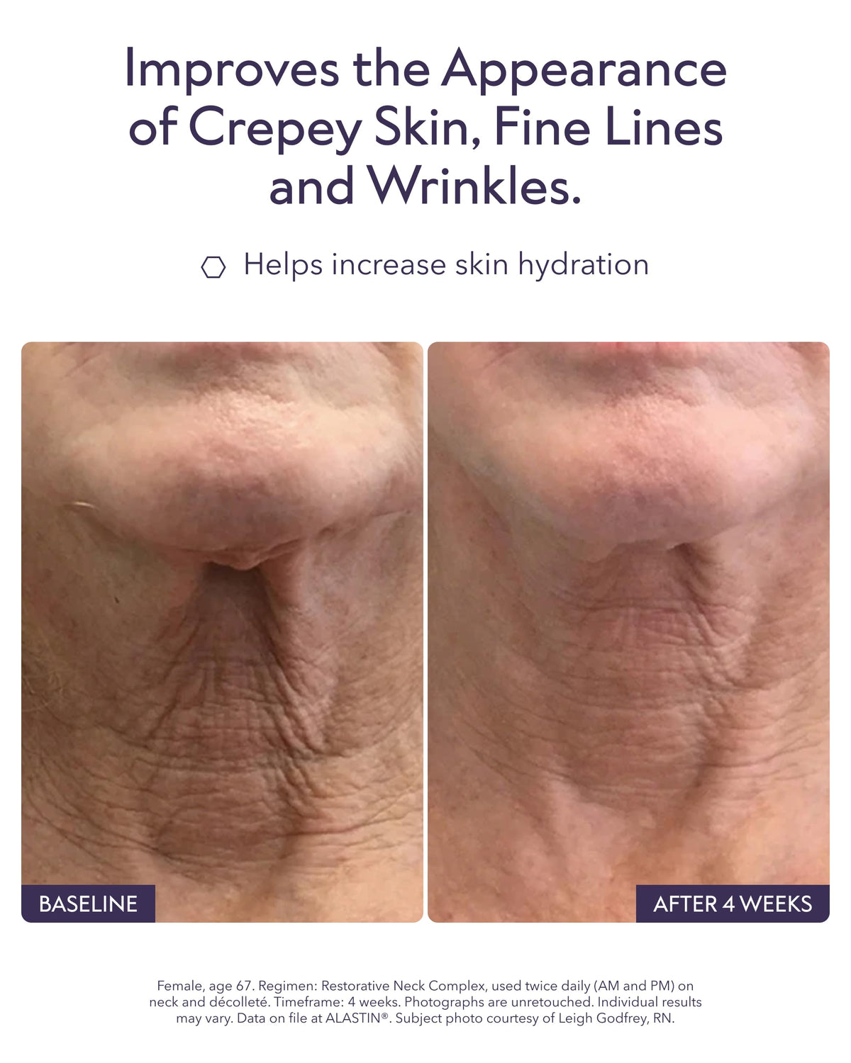 ALASTIN serum texture close-up illustrating lightweight hydrating finish