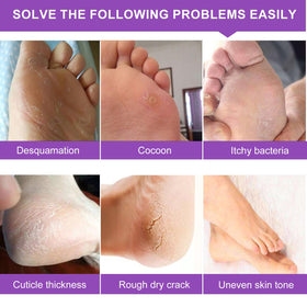 ALIVER foot mask applied on feet with outer socks demonstrating wearable design