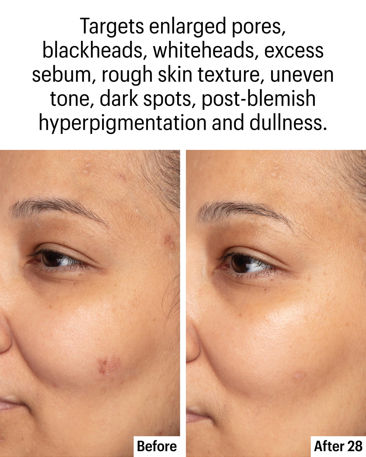 Allies of Skin label listing actives and claims to inform shoppers
