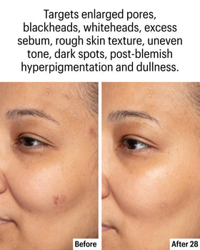 Allies of Skin label listing actives and claims to inform shoppers