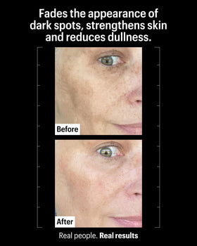 Allies of Skin ingredient label highlighting tranexamic acid and alpha arbutin for targeted brightening