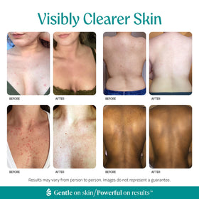 Almond Clear mandelic serum texture close-up showing smooth, lightweight consistency
