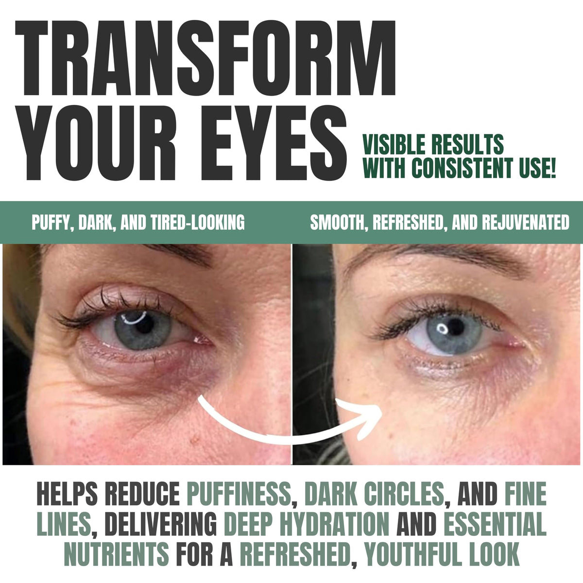 Alozera shown on under-eye area reducing puffiness and refreshing skin