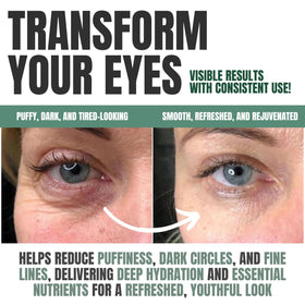 Alozera shown on under-eye area reducing puffiness and refreshing skin